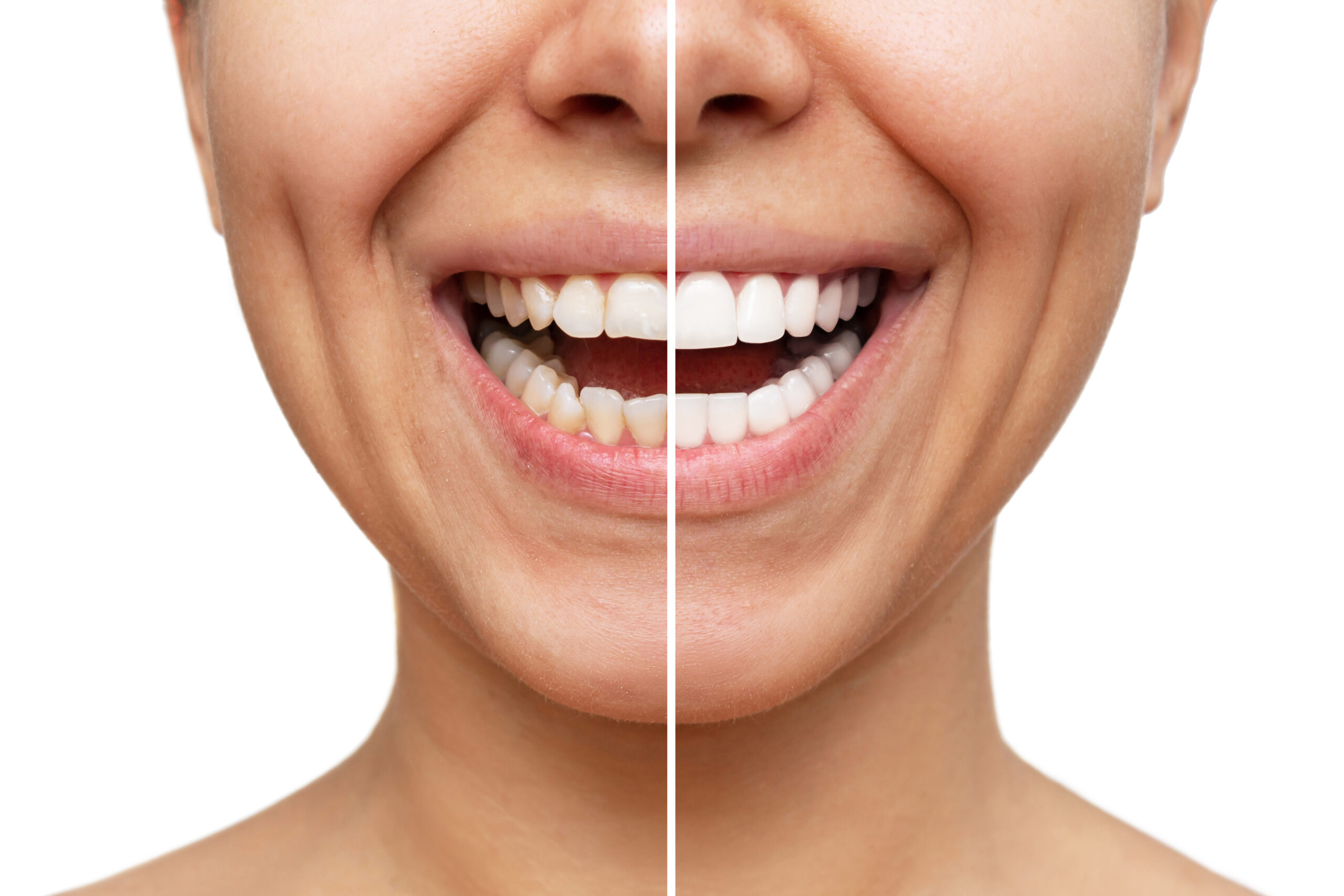 AdobeStock 529242198 scaled